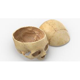 Real Human Skull Cranial 02 Cut With Piece Pose 04 3D model